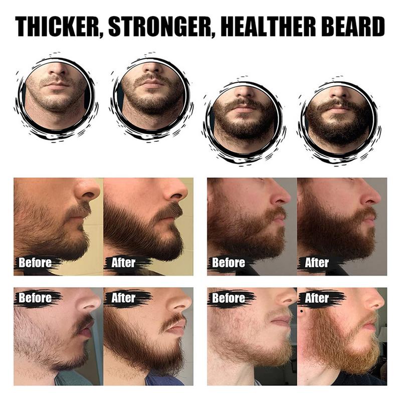 5pcs Men Beard Barba Grooming  - đánh giá và giá Men'S Grooming Tonic